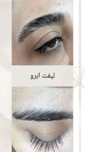 تست حساسیت در آیا لیفت مژه باعث ریزش میشود؟