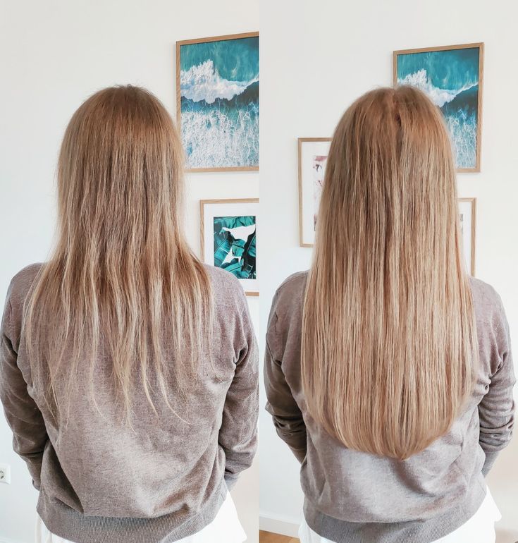 اوزون تراپی در نکات مهم برای حفظ نتایج احیای مو در بهترین سالن زیبایی کرج